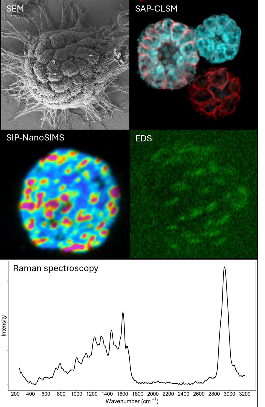 Techniques used in my work: SEM, SAP-CLSM, SIP-NanoSIMS, EDS, Raman spectroscopy